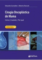 CIRUGIA ONCOPLASTICA DE MAMA. COMO - CUANDO - POR QUE (INCLUYE ACCESO ONLINE)