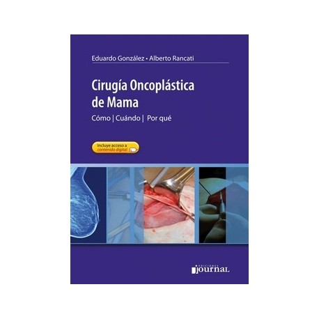 CIRUGIA ONCOPLASTICA DE MAMA. COMO - CUANDO - POR QUE (INCLUYE ACCESO ONLINE)