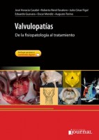 VALVULOPATIAS. DE LA FISIOPATOLOGIA AL TRATAMIENTO + ACCESO ONLINE
