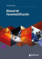 MANUAL DE FACOEMULSIFICACION + ACCESO ONLINE
