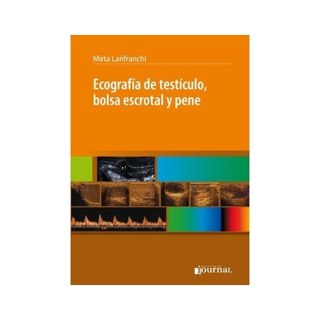 ECOGRAFIA DE TESTICULO, BOLSA ESCROTAL Y PENE