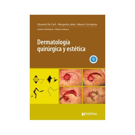 DERMATOLOGIA QUIRURGICA Y ESTETICA