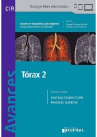 AVANCES EN DIAGNOSTICO POR IMAGENES 17: TORAX 2 (CIR, COLEGIO INTERAMERICANO DE RADIOLOGIA (LIBRO + LIBRO ELECTRONICO)