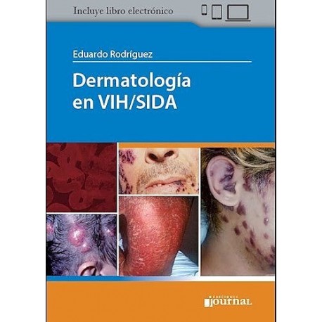 DERMATOLOGIA EN VIH/SIDA (INCLUYE E-BOOK)