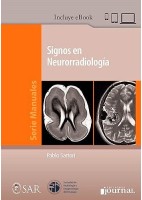 SIGNOS EN NEURORRADIOLOGIA (INCLUYE E-BOOK)