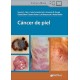 CANCER DE PIEL