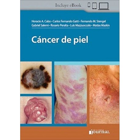 CANCER DE PIEL