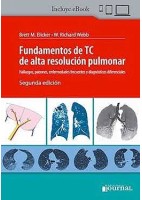 FUNDAMENTOS DE TC DE ALTA RESOLUCION PULMONAR (INCLUYE E-BOOK)