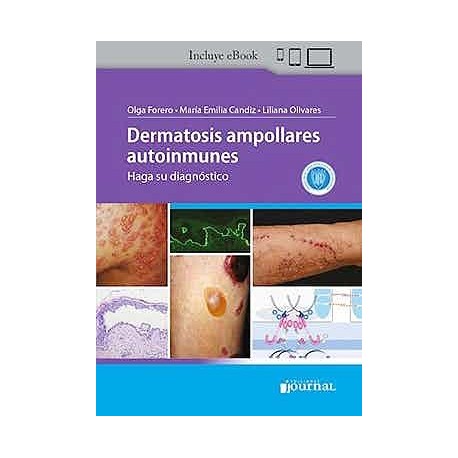 DERMATOSIS AMPOLLARES AUTOINMUNES. HAGA SU DIAGNOSTICO