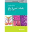 ATLAS DE ENFERMEDADES DE LA VULVA
