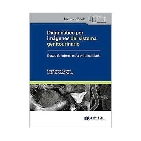 DIAGNOSTICO POR IMAGENES DEL SISTEMA GENITOURINARIO. CASOS DE INTERES EN LA PRACTICA DIARIA