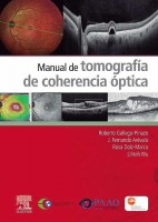 MANUAL DE TOMOGRAFIA DE COHERENDIA OPTICA