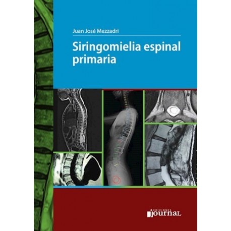 SIRINGOMIELIA ESPINAL PRIMARIA