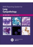 WHO REPORTING SYSTEM FOR LUNG CYTOPAHTOLOGY