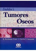 DAHLIN.S TUMORES OSEOS