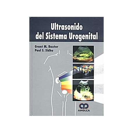 ULTRASONIDO DEL SISTEMA UROGENITAL