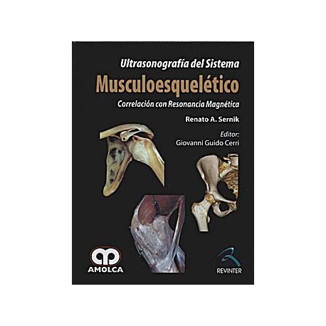 ULTRASONOGRAFIA DEL SISTEMA MUSCULOESQUELETICO. CORRELACION CON RESONANCIA MAGNETICA