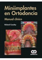 MINIIMPLANTES EN ORTODONCIA. MANUAL CLINICO
