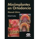 MINIIMPLANTES EN ORTODONCIA. MANUAL CLINICO