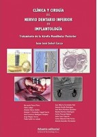 CLINICA Y CIRUGIA DEL NERVIO DENTARIO INFERIOR EN IMPLANTOLOGIA