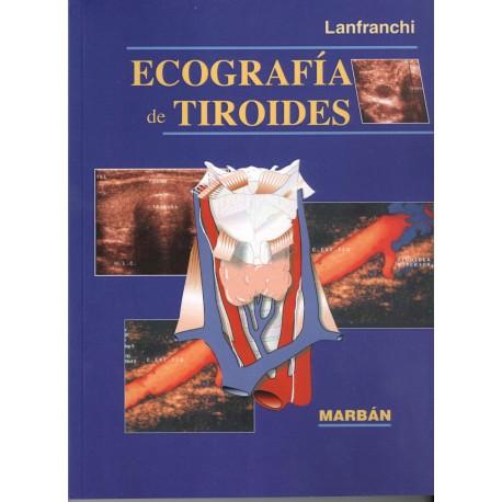 ECOGRAFIA DE TIROIDES