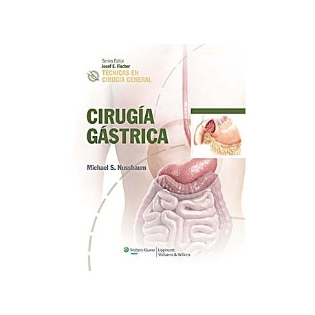 CIRUGIA GASTRICA