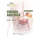 CIRUGIA GASTRICA