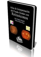 ATLAS DE INTERPRETACION DEL FONDO OCULAR CON RETINOICONOS