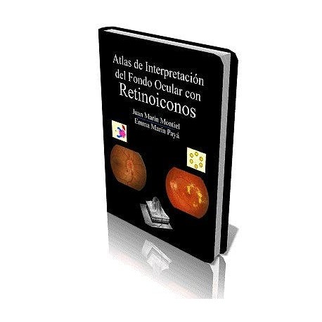 ATLAS DE INTERPRETACION DEL FONDO OCULAR CON RETINOICONOS