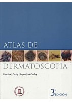 ATLAS DE DERMATOSCOPIA