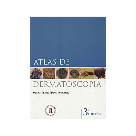ATLAS DE DERMATOSCOPIA