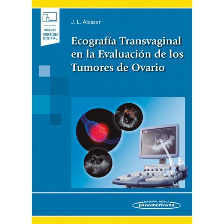 ECOGRAFIA TRANSVAGINAL EN LA EVALUACION DE LOS TUMORES DE OVARIO (INCLUYE VERISON DIGITAL)