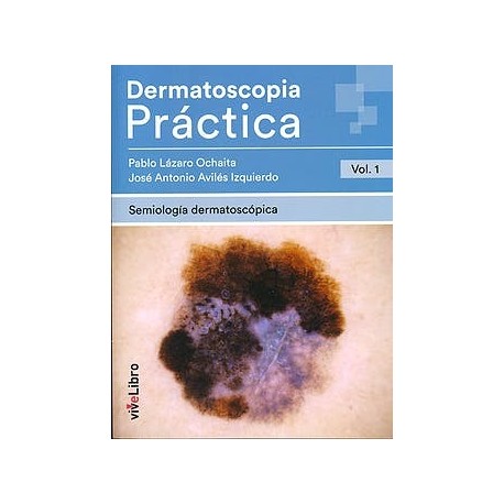 DERMATOSCOPIA PRACTICA (VOL.1) SEMIOLOGIA DERMATOSCOPICA