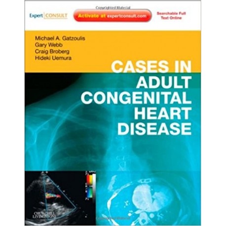 CASES IN ADULT CONGENITAL HEART DISEASE ONLINE AND PRINT