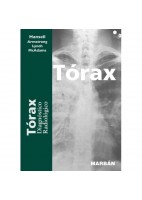 TORAX. DIAGNOSTICO RADIOLOGICO DE RESIDENTE 17