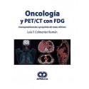 ONCOLOGIA Y PET/CT CON FDG
