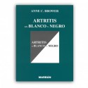 ARTRITIS EN BLANCO Y NEGRO