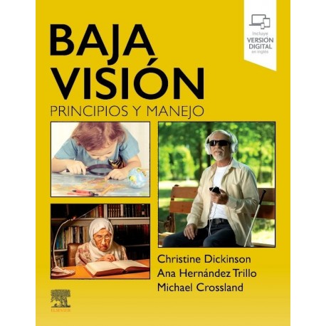 BAJA VISION. PRINCIPIOS Y MANEJO (INCLUYE VERSION DIGITAL EN INGLES)