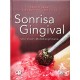 SONRISA GINGIVAL