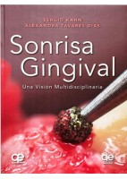 SONRISA GINGIVAL