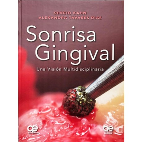 SONRISA GINGIVAL