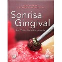 SONRISA GINGIVAL
