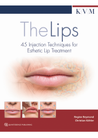 THE LIPS. 45 INJECTION TECHNIQUES FOR ESTHETIC LIP TREATMENT