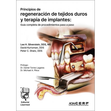 PRINCIPIOS DE REGENERACION DE TEJIDOS DUROS Y TERAPIA DE IMPLANTES