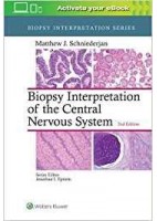 BIOPSY INTERPRETATION OF THE CENTRAL NERVOUS SYSTEM