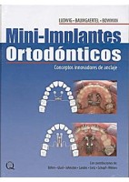 MINI-IMPLANTES ORTODONTICOS