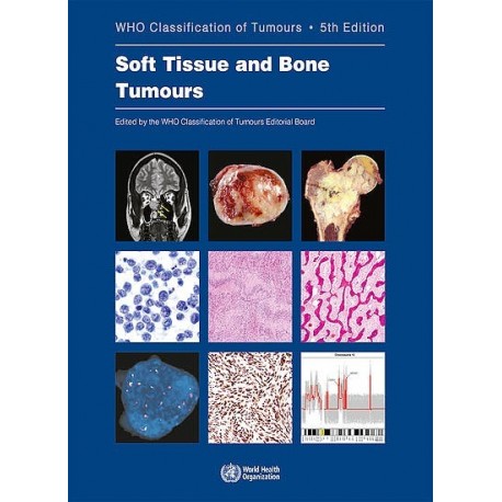 WHO CLASSIFICATION OF TUMOURS: SOFT TISSUE AND BONE TUMOURS