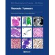 WHO CLASSIFICATION OF TUMOURS: THORACIC TUMOURS