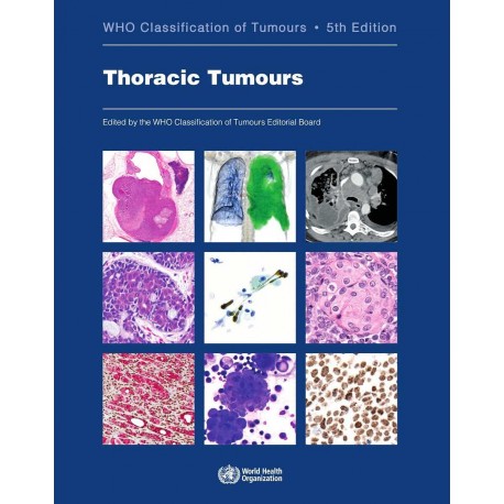 WHO CLASSIFICATION OF TUMOURS: THORACIC TUMOURS