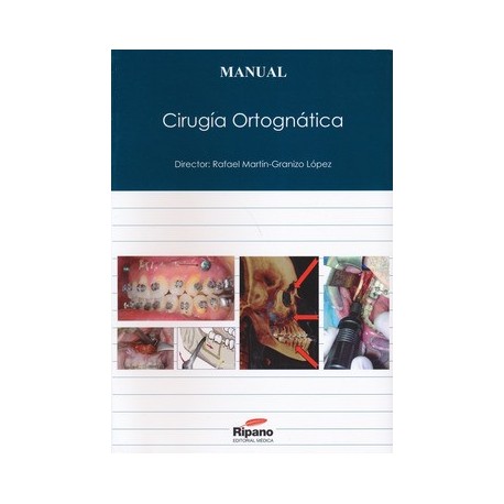 MANUAL DE CIRUGIA ORTOGNATICA